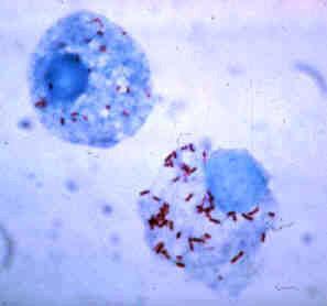 Rickettsia_rickettsii