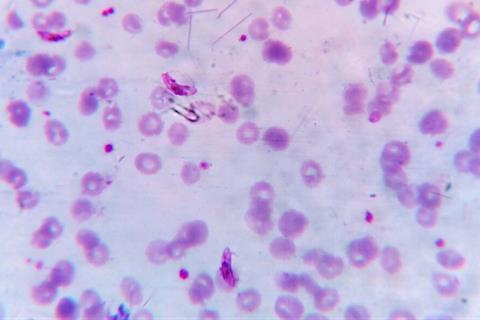 Plasmodium_falciparum_gametocyte