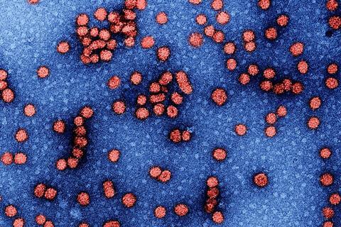 Hepatitis_b (1)