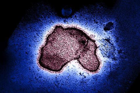 Human_Respiratory_Syncytial_Virus_(RSV)_-_2111