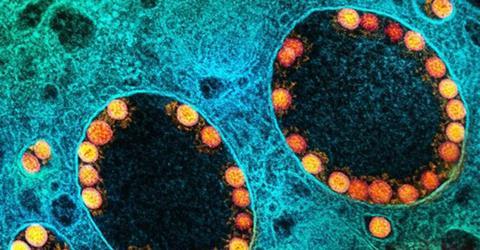 Low-Res_COVID-19 NIAID