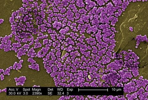 Fig. 3 MRSA