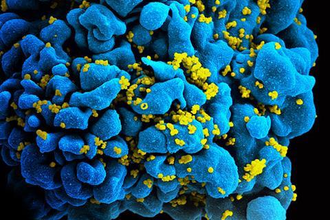 HIV_H9_T-cell