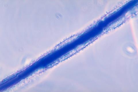 Aspergillus_flavus_01