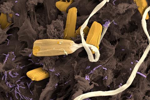 False-coloured scanning electron micrograph of sea turtle carapace scute with diatom cells (yellow) surrounded by extracellular polysaccharides and bacteria (purple). SEM image by Sunčica Bosak, colorised by Klara Filek.