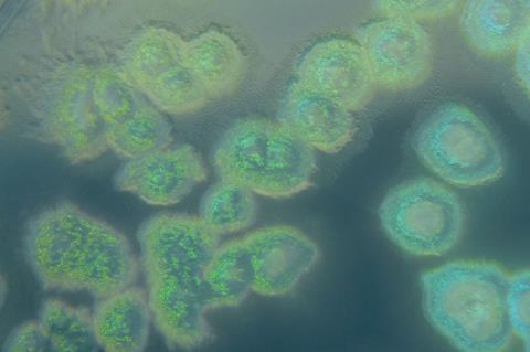 Pseudomonas_aeruginosa_on_cetrimide_agar