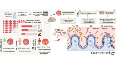 Low-Res_Web image for Gastro study on IBD and gut inflammation (1)