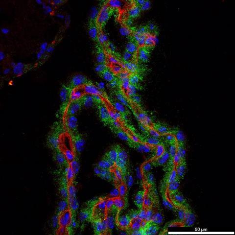 Low-Res_mouse choroid plexus