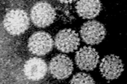 Papilloma_Virus_(HPV)_EM_(new_version)
