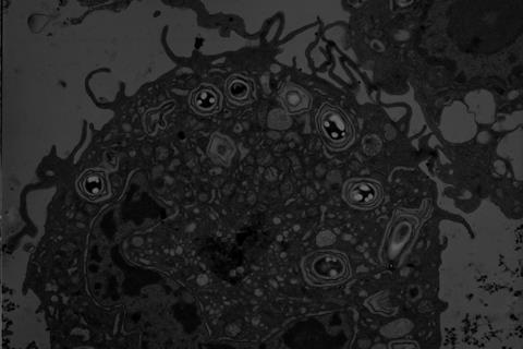 thumbnail_BA spores in a murine macrophage