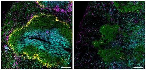 Low-Res_efecte-vacunes-mes-enlla-infeccio