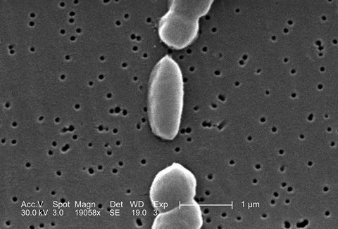Vibrio_parahaemolyticus_01