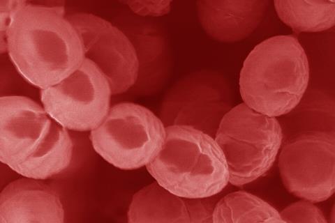 Lactococcus_lactis,_scanning_electron_micrograph
