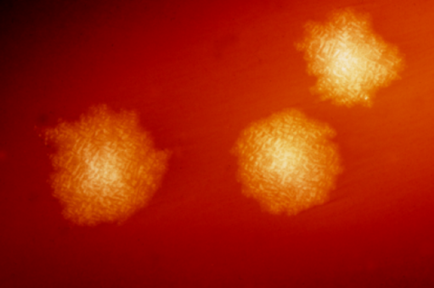 Clostridium_difficile_colonies