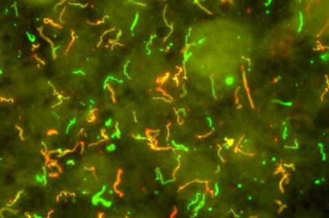 Lyme_Disease_Bacteria,_Borrelia_burgdorferi_(5661846104)