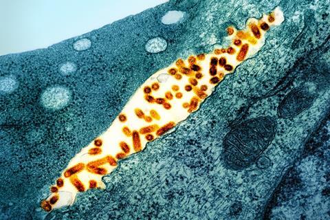 Vesicular_Stomatitis_Virus_(VSV)_particles_(orange)_found_in_extracellular_space_and_budding_from_the_plasma_membrane_of_infected_cells_(teal)