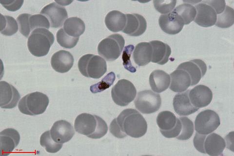 P.falciparum-gametocytes