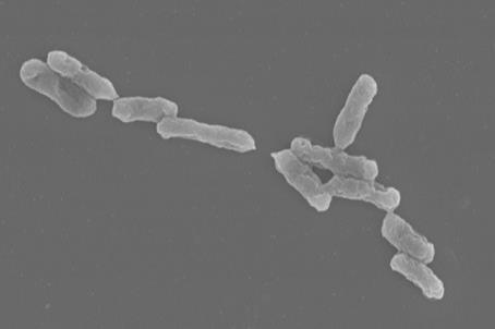 Acidithiobacillus_ferrooxidans