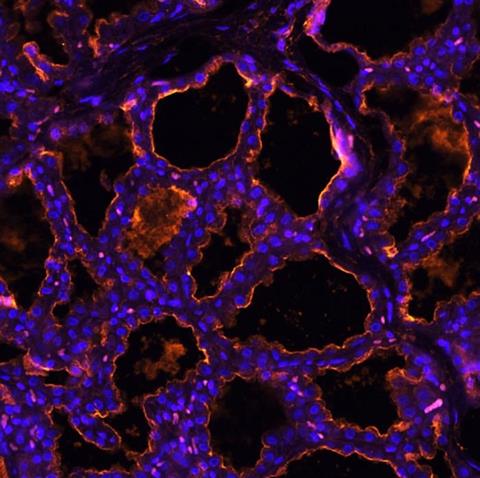 Low-Res_flureceptros12-25_2