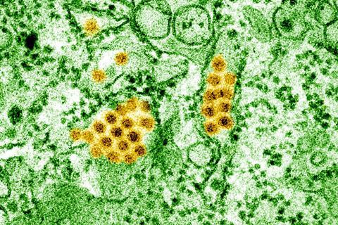 Dengue_Virus_Particles_(53253718295)