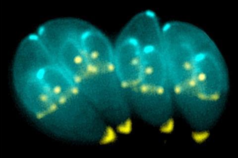 Toxoplasma_gondii