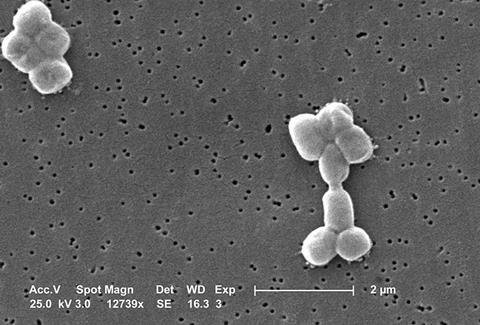 Acinetobacter_baumannii,_SEM,_9330_lores