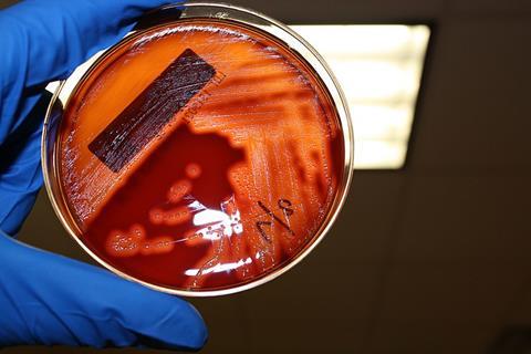 Streptococcus_pyogenes_agar_sangre