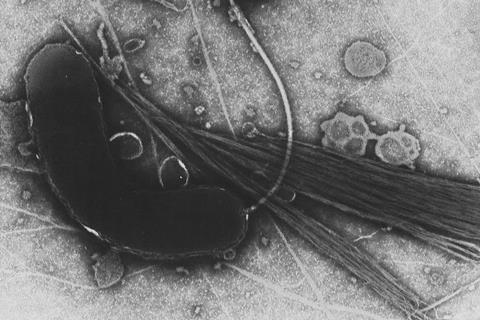 960px-Vibrio_cholerae