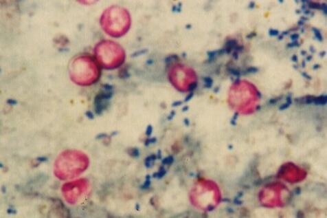 Cryptosporidium_parvum_02 (1)