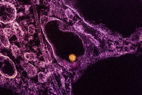 West_Nile_Virus_Particle