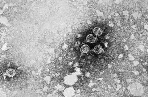 Hepatitis_B_virus_01
