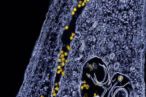 West_Nile_Virus_particles