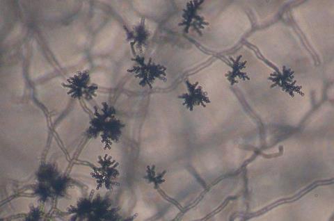 800px-Cladosporium_sp_conidia