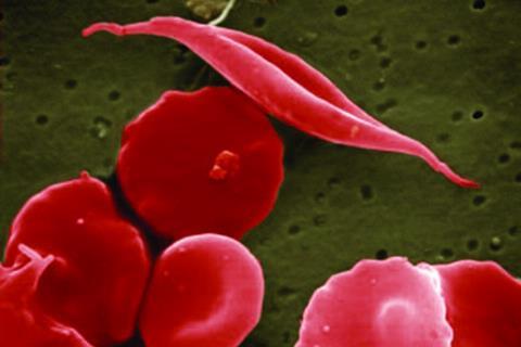 Sickle_cells_illustration