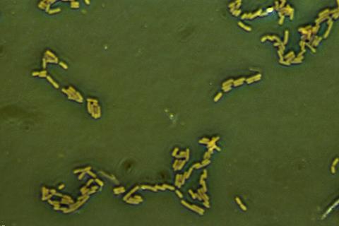 Escherichia_coli_(257_06)_Gramnegative_rods (1)