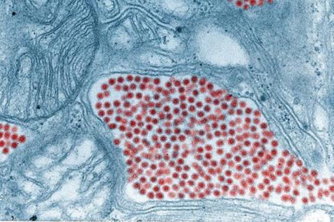 Eastern_equine_encephalitis