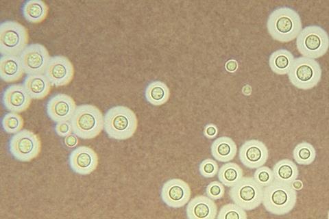 Cryptococcus_neoformans_using_a_light_India_ink_staining_preparation_PHIL_3771_lores