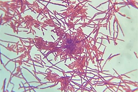 Pseudomonas_fluorescens_Gram_Stain_on_Microscope_Slide (1)