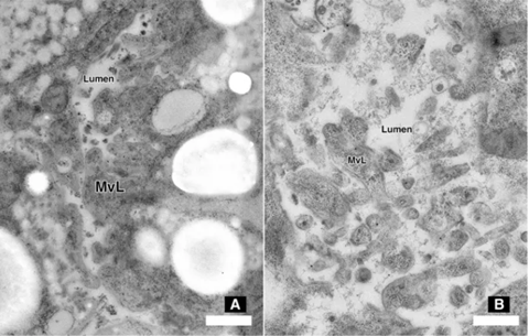 Anterior midgut ultrastructure in soybean cyst nematodes