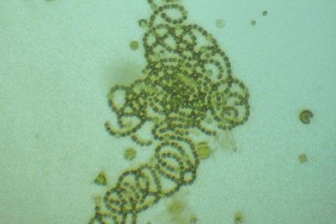 960px-Dolichospermum_crassum