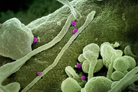 Crimean-Congo_Hemorrhagic_Fever_(CCHF)_Virus_-_3