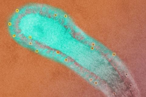 Human_Respiratory_Syncytial_Virus_(RSV)_(52453014952)