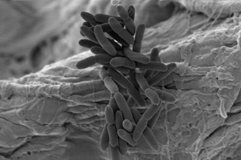 Paraburkholderia_solitsuga_SEM1.tif