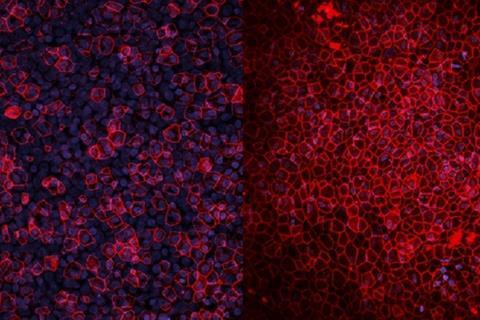 Low-Res_Unhealthy mini lung left, healthy right.jpg