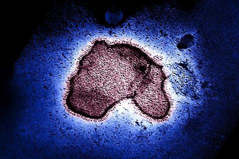 Human_Respiratory_Syncytial_Virus_(RSV)_-_2111