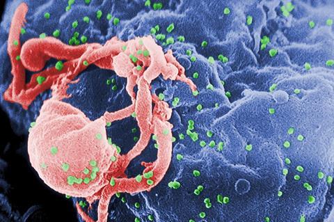 960px-HIV-budding-Color