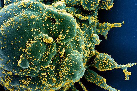 SARS-COV-2_virus (2)