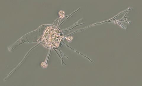 Bdelloid rotifer Infected and killed by fungal infection Credit Chris G Wilson_1