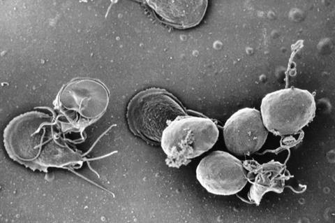 Giardia_lamblia_culture