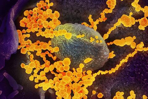 SARS-CoV-2_scanning_electron_microscope_image